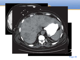 Powerpoint Templates
Page 49
 