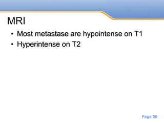 Powerpoint Templates
Page 50
MRI
• Most metastase are hypointense on T1
• Hyperintense on T2
 