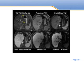 Powerpoint Templates
Page 51
 