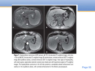 Powerpoint Templates
Page 55
 