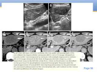 Powerpoint Templates
Page 56
 