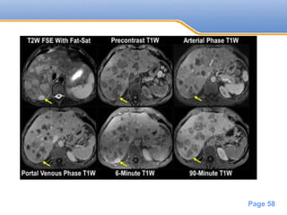 Powerpoint Templates
Page 58
 