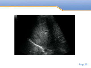 Powerpoint Templates
Page 59
 