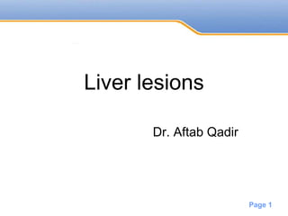 Powerpoint Templates
Page 1
Liver lesions
Dr. Aftab Qadir
 