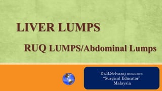 LIVER LUMPS
RUQ LUMPS/Abdominal Lumps
AN OVRVIEW
Dr.B.Selvaraj MS;Mch;FICS;
“Surgical Educator”
Malaysia
 
