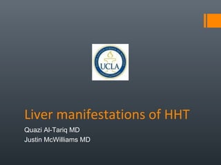 Liver manifestations of HHT
Quazi Al-Tariq MD
Justin McWilliams MD
 