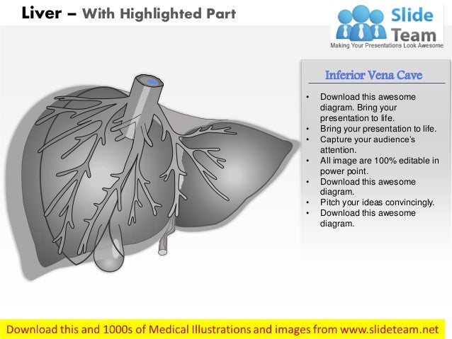 Liver medical images for power point