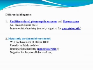 Differential diagnosis
1. Undifferentiated pleomorphic sarcoma and fibrosarcoma
No area of classic HCC
Immunohistochemistry (entirely negative for pancytokeratin)
2. Metastatic sarcomatoid carcinoma:
Will not have area of classic HCC
Usually multiple nodules
Immunohistochemistry (pancytokeratin+)
Negative for hepatocellular markers,
 
