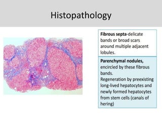 Histopathology
 