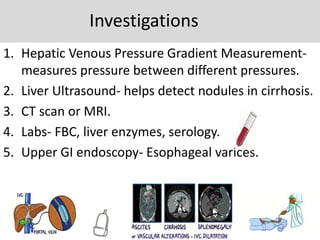 Investigations
1. Hepatic Venous Pressure Gradient Measurement-
measures pressure between different pressures.
2. Liver Ultrasound- helps detect nodules in cirrhosis.
3. CT scan or MRI.
4. Labs- FBC, liver enzymes, serology.
5. Upper GI endoscopy- Esophageal varices.
 