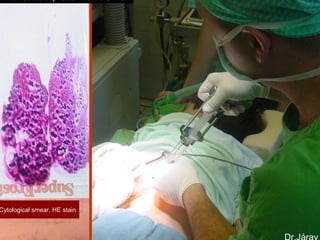 Cytological smear, HE stain
Fine needle aspiration from the liver
 