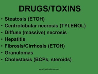 DRUGS/TOXINS Steatosis (ETOH) Centrolobular necrosis (TYLENOL) Diffuse (massive) necrosis Hepatitis Fibrosis/Cirrhosis (ETOH) Granulomas Cholestasis (BCPs, steroids) www.freelivedoctor.com 
