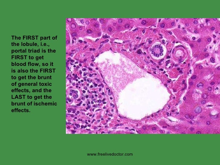 Liver pothology