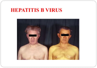 HEPATITIS D VIRUS 
 