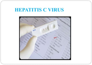 HEPATITIS E VIRUS: 
 