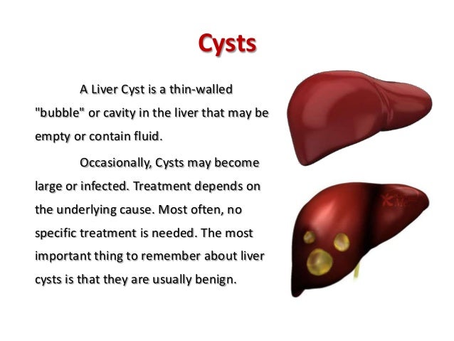 Liver Cyst Natural Treatment Liver Cyst Natural Treatment