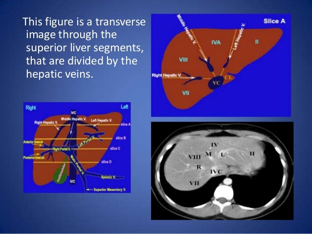 liver segmental anatomy liver segments