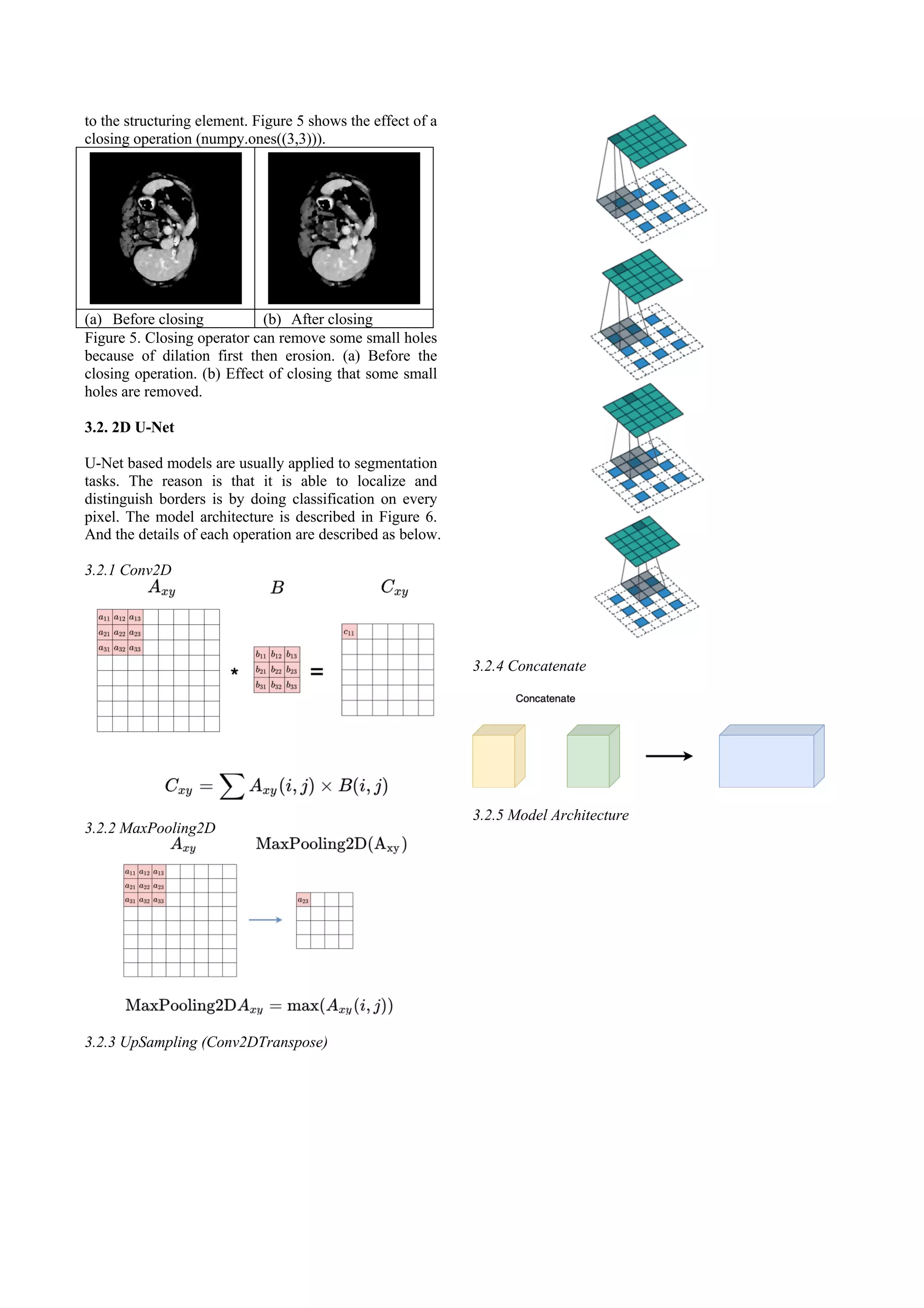to the structuring element. Figure 5 shows the effect of a
closing operation (numpy.ones((3,3))).
(a) Before closing (b) After closing
Figure 5. Closing operator can remove some small holes
because of dilation first then erosion. (a) Before the
closing operation. (b) Effect of closing that some small
holes are removed.
3.2. 2D U-Net
U-Net based models are usually applied to segmentation
tasks. The reason is that it is able to localize and
distinguish borders is by doing classification on every
pixel. The model architecture is described in Figure 6.
And the details of each operation are described as below.
3.2.1 Conv2D
3.2.2 MaxPooling2D
3.2.3 UpSampling (Conv2DTranspose)
3.2.4 Concatenate
3.2.5 Model Architecture
 