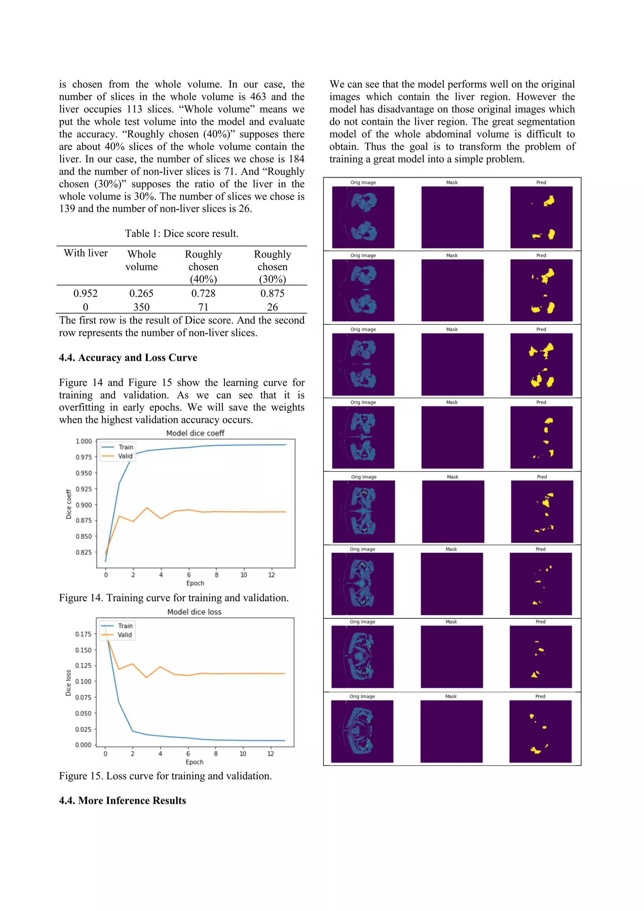 is chosen from the whole volume. In our case, the
number of slices in the whole volume is 463 and the
liver occupies 113 slices. “Whole volume” means we
put the whole test volume into the model and evaluate
the accuracy. “Roughly chosen (40%)” supposes there
are about 40% slices of the whole volume contain the
liver. In our case, the number of slices we chose is 184
and the number of non-liver slices is 71. And “Roughly
chosen (30%)” supposes the ratio of the liver in the
whole volume is 30%. The number of slices we chose is
139 and the number of non-liver slices is 26.
Table 1: Dice score result.
With liver Whole
volume
Roughly
chosen
(40%)
Roughly
chosen
(30%)
0.952
0
0.265
350
0.728
71
0.875
26
The first row is the result of Dice score. And the second
row represents the number of non-liver slices.
4.4. Accuracy and Loss Curve
Figure 14 and Figure 15 show the learning curve for
training and validation. As we can see that it is
overfitting in early epochs. We will save the weights
when the highest validation accuracy occurs.
Figure 14. Training curve for training and validation.
Figure 15. Loss curve for training and validation.
4.4. More Inference Results
We can see that the model performs well on the original
images which contain the liver region. However the
model has disadvantage on those original images which
do not contain the liver region. The great segmentation
model of the whole abdominal volume is difficult to
obtain. Thus the goal is to transform the problem of
training a great model into a simple problem.
 
