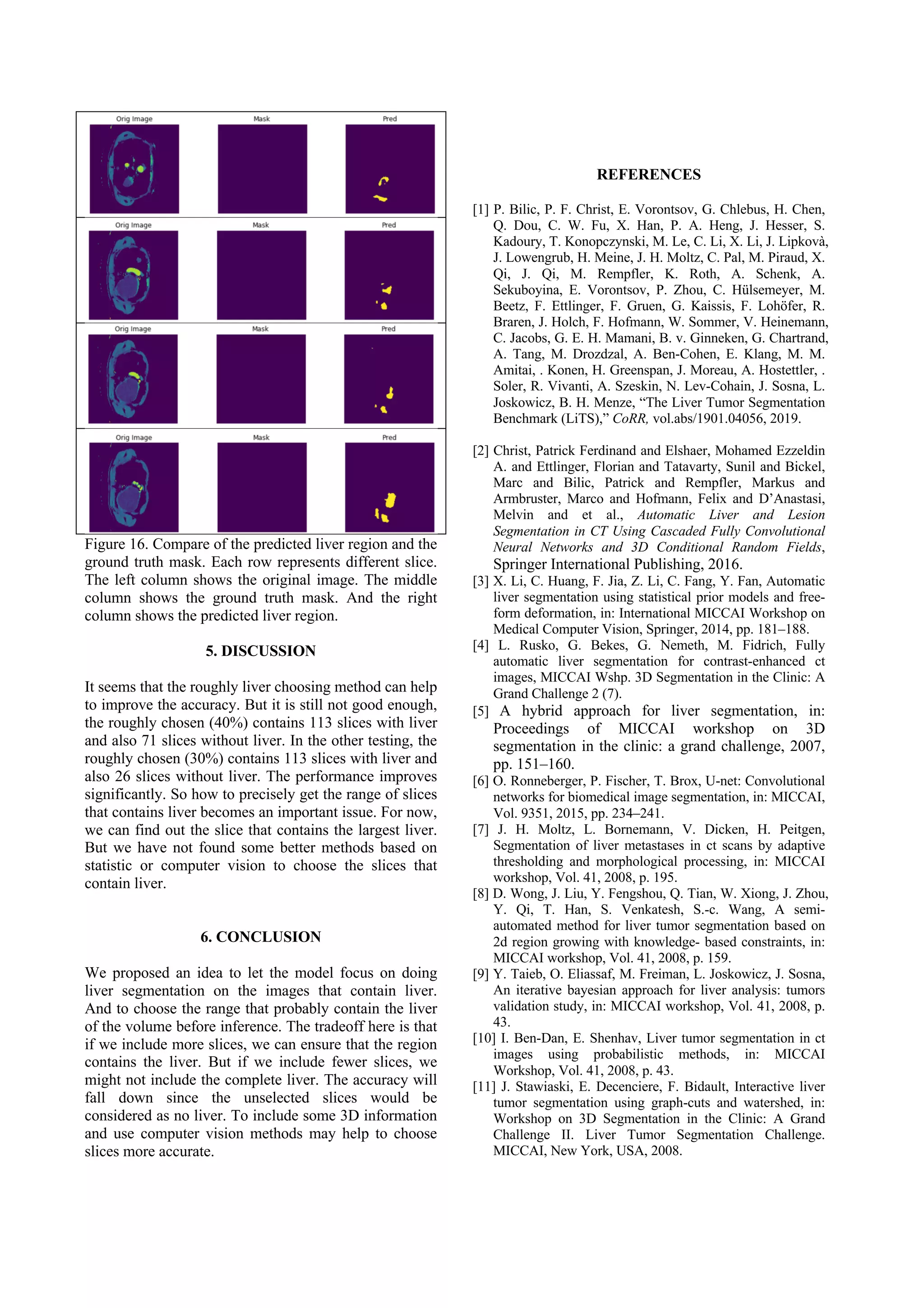 Figure 16. Compare of the predicted liver region and the
ground truth mask. Each row represents different slice.
The left column shows the original image. The middle
column shows the ground truth mask. And the right
column shows the predicted liver region.
5. DISCUSSION
It seems that the roughly liver choosing method can help
to improve the accuracy. But it is still not good enough,
the roughly chosen (40%) contains 113 slices with liver
and also 71 slices without liver. In the other testing, the
roughly chosen (30%) contains 113 slices with liver and
also 26 slices without liver. The performance improves
significantly. So how to precisely get the range of slices
that contains liver becomes an important issue. For now,
we can find out the slice that contains the largest liver.
But we have not found some better methods based on
statistic or computer vision to choose the slices that
contain liver.
6. CONCLUSION
We proposed an idea to let the model focus on doing
liver segmentation on the images that contain liver.
And to choose the range that probably contain the liver
of the volume before inference. The tradeoff here is that
if we include more slices, we can ensure that the region
contains the liver. But if we include fewer slices, we
might not include the complete liver. The accuracy will
fall down since the unselected slices would be
considered as no liver. To include some 3D information
and use computer vision methods may help to choose
slices more accurate.
REFERENCES
[1] P. Bilic, P. F. Christ, E. Vorontsov, G. Chlebus, H. Chen,
Q. Dou, C. W. Fu, X. Han, P. A. Heng, J. Hesser, S.
Kadoury, T. Konopczynski, M. Le, C. Li, X. Li, J. Lipkovà,
J. Lowengrub, H. Meine, J. H. Moltz, C. Pal, M. Piraud, X.
Qi, J. Qi, M. Rempfler, K. Roth, A. Schenk, A.
Sekuboyina, E. Vorontsov, P. Zhou, C. Hülsemeyer, M.
Beetz, F. Ettlinger, F. Gruen, G. Kaissis, F. Lohöfer, R.
Braren, J. Holch, F. Hofmann, W. Sommer, V. Heinemann,
C. Jacobs, G. E. H. Mamani, B. v. Ginneken, G. Chartrand,
A. Tang, M. Drozdzal, A. Ben-Cohen, E. Klang, M. M.
Amitai, . Konen, H. Greenspan, J. Moreau, A. Hostettler, .
Soler, R. Vivanti, A. Szeskin, N. Lev-Cohain, J. Sosna, L.
Joskowicz, B. H. Menze, “The Liver Tumor Segmentation
Benchmark (LiTS),” CoRR, vol.abs/1901.04056, 2019.
[2] Christ, Patrick Ferdinand and Elshaer, Mohamed Ezzeldin
A. and Ettlinger, Florian and Tatavarty, Sunil and Bickel,
Marc and Bilic, Patrick and Rempfler, Markus and
Armbruster, Marco and Hofmann, Felix and D’Anastasi,
Melvin and et al., Automatic Liver and Lesion
Segmentation in CT Using Cascaded Fully Convolutional
Neural Networks and 3D Conditional Random Fields,
Springer International Publishing, 2016.
[3] X. Li, C. Huang, F. Jia, Z. Li, C. Fang, Y. Fan, Automatic
liver segmentation using statistical prior models and free-
form deformation, in: International MICCAI Workshop on
Medical Computer Vision, Springer, 2014, pp. 181–188.
[4] L. Rusko, G. Bekes, G. Nemeth, M. Fidrich, Fully
automatic liver segmentation for contrast-enhanced ct
images, MICCAI Wshp. 3D Segmentation in the Clinic: A
Grand Challenge 2 (7).
[5] A hybrid approach for liver segmentation, in:
Proceedings of MICCAI workshop on 3D
segmentation in the clinic: a grand challenge, 2007,
pp. 151–160.	
[6] O. Ronneberger, P. Fischer, T. Brox, U-net: Convolutional
networks for biomedical image segmentation, in: MICCAI,
Vol. 9351, 2015, pp. 234–241.
[7] J. H. Moltz, L. Bornemann, V. Dicken, H. Peitgen,
Segmentation of liver metastases in ct scans by adaptive
thresholding and morphological processing, in: MICCAI
workshop, Vol. 41, 2008, p. 195.
[8] D. Wong, J. Liu, Y. Fengshou, Q. Tian, W. Xiong, J. Zhou,
Y. Qi, T. Han, S. Venkatesh, S.-c. Wang, A semi-
automated method for liver tumor segmentation based on
2d region growing with knowledge- based constraints, in:
MICCAI workshop, Vol. 41, 2008, p. 159.
[9] Y. Taieb, O. Eliassaf, M. Freiman, L. Joskowicz, J. Sosna,
An iterative bayesian approach for liver analysis: tumors
validation study, in: MICCAI workshop, Vol. 41, 2008, p.
43.
[10] I. Ben-Dan, E. Shenhav, Liver tumor segmentation in ct
images using probabilistic methods, in: MICCAI
Workshop, Vol. 41, 2008, p. 43.
[11] J. Stawiaski, E. Decenciere, F. Bidault, Interactive liver
tumor segmentation using graph-cuts and watershed, in:
Workshop on 3D Segmentation in the Clinic: A Grand
Challenge II. Liver Tumor Segmentation Challenge.
MICCAI, New York, USA, 2008.	
 