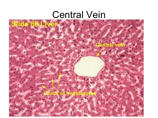 liver slides liver slide