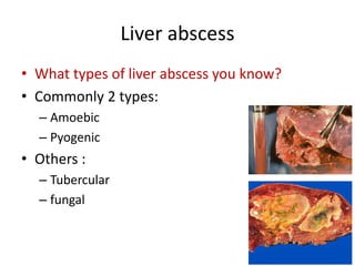 Liver specimen: Hepatocellular carcinoma, liver abscess | PPTX