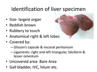 Liver specimen: Hepatocellular carcinoma, liver abscess | PPTX
