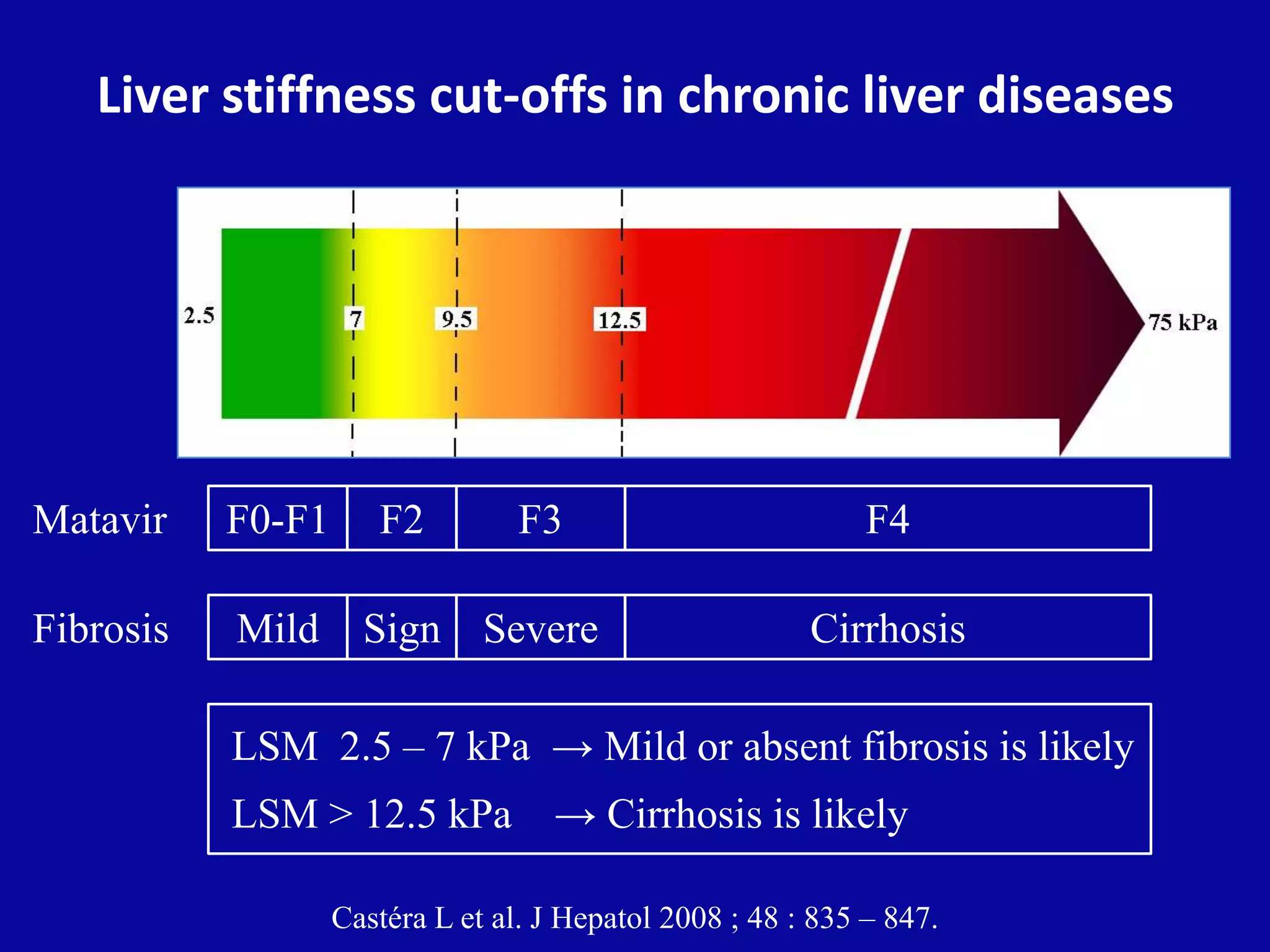 Liver stiffness cut-offs in chronic liver diseases
F2
Sign
F3
Severe
F4
Cirrhosis
Matavir F0-F1
MildFibrosis
Castéra L et al. J Hepatol 2008 ; 48 : 835 – 847.
LSM 2.5 – 7 kPa → Mild or absent fibrosis is likely
LSM > 12.5 kPa → Cirrhosis is likely
 