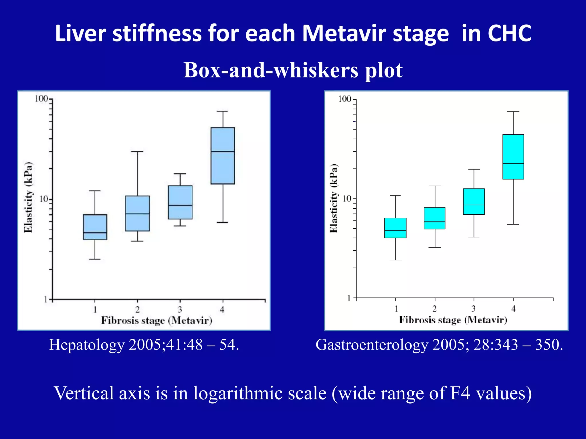 Liver stiffness for each Metavir stage in CHC
Box-and-whiskers plot
Vertical axis is in logarithmic scale (wide range of F4 values)
Gastroenterology 2005; 28:343 – 350.Hepatology 2005;41:48 – 54.
 