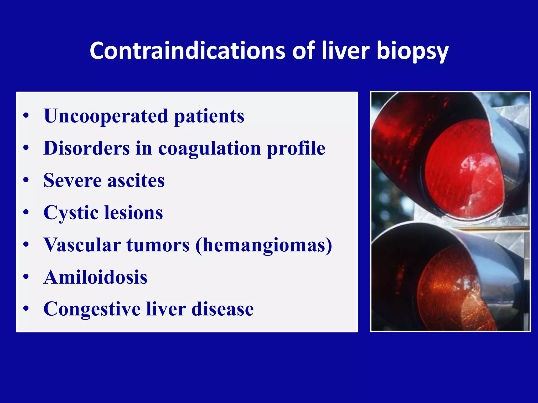 Contraindications of liver biopsy
• Uncooperated patients
• Disorders in coagulation profile
• Severe ascites
• Cystic lesions
• Vascular tumors (hemangiomas)
• Amiloidosis
• Congestive liver disease
 