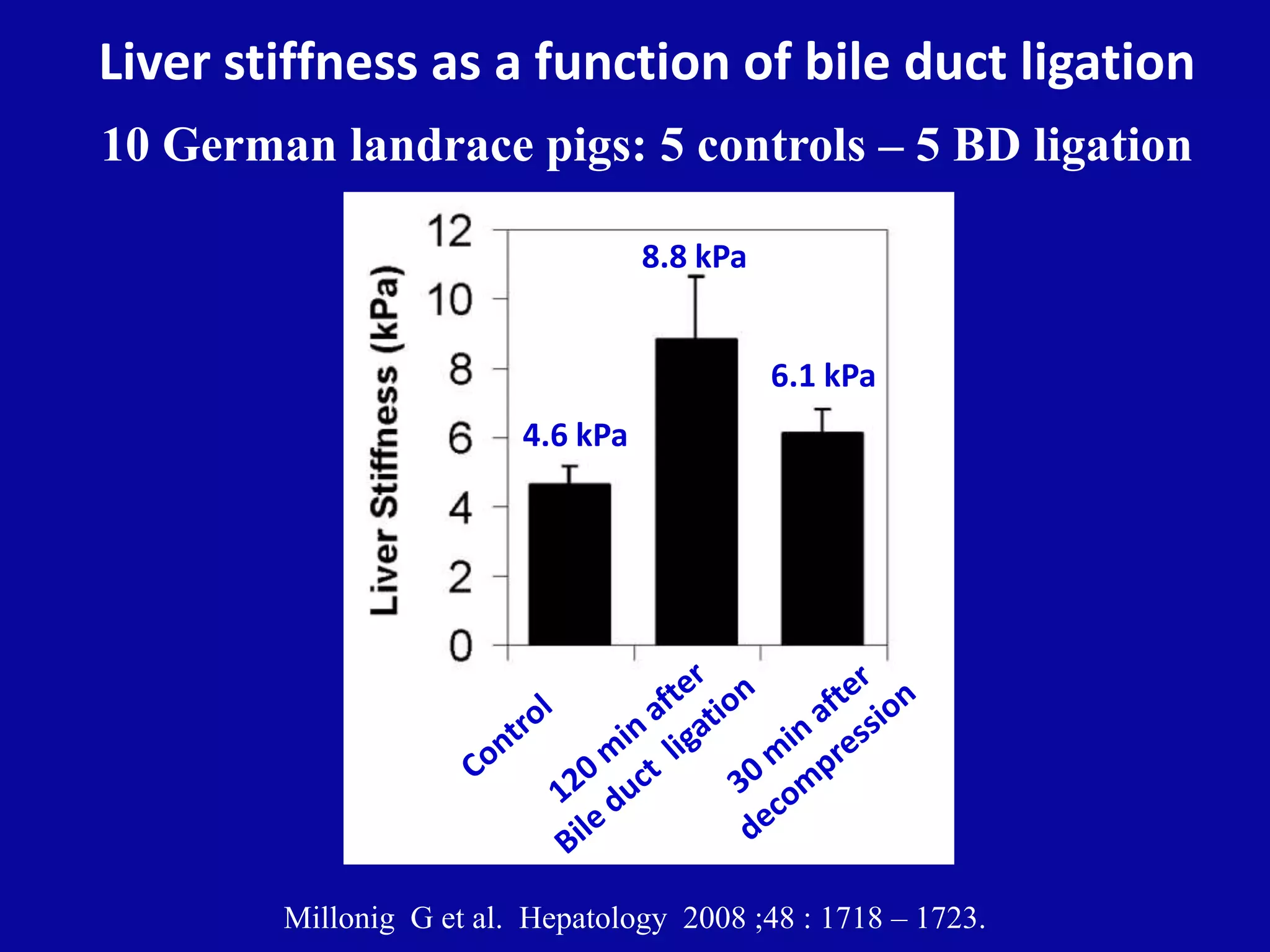 Liver stiffness as a function of bile duct ligation
10 German landrace pigs: 5 controls – 5 BD ligation
Millonig G et al. Hepatology 2008 ;48 : 1718 – 1723.
4.6 kPa
8.8 kPa
6.1 kPa
 