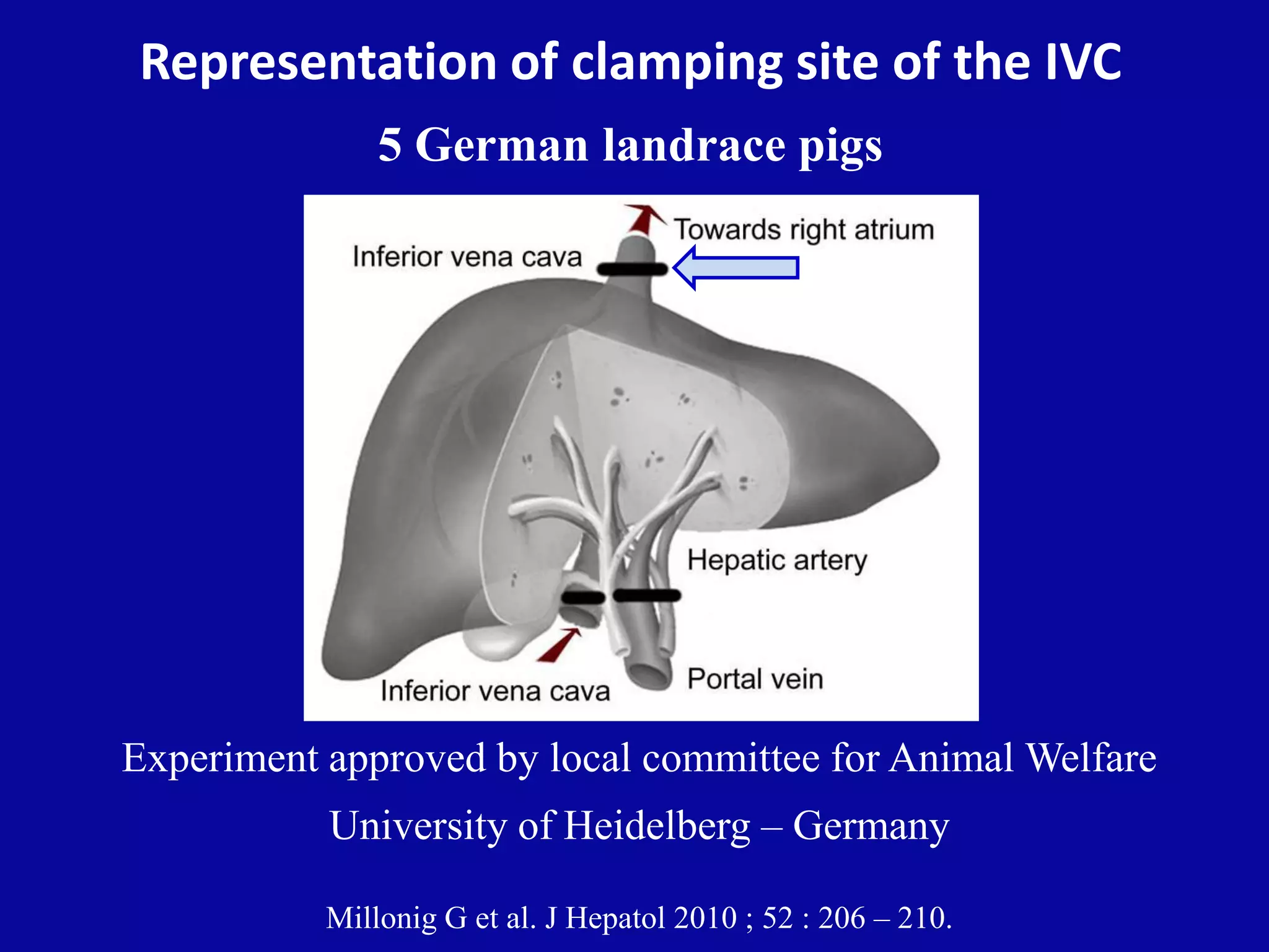 Representation of clamping site of the IVC
5 German landrace pigs
Millonig G et al. J Hepatol 2010 ; 52 : 206 – 210.
Experiment approved by local committee for Animal Welfare
University of Heidelberg – Germany
 