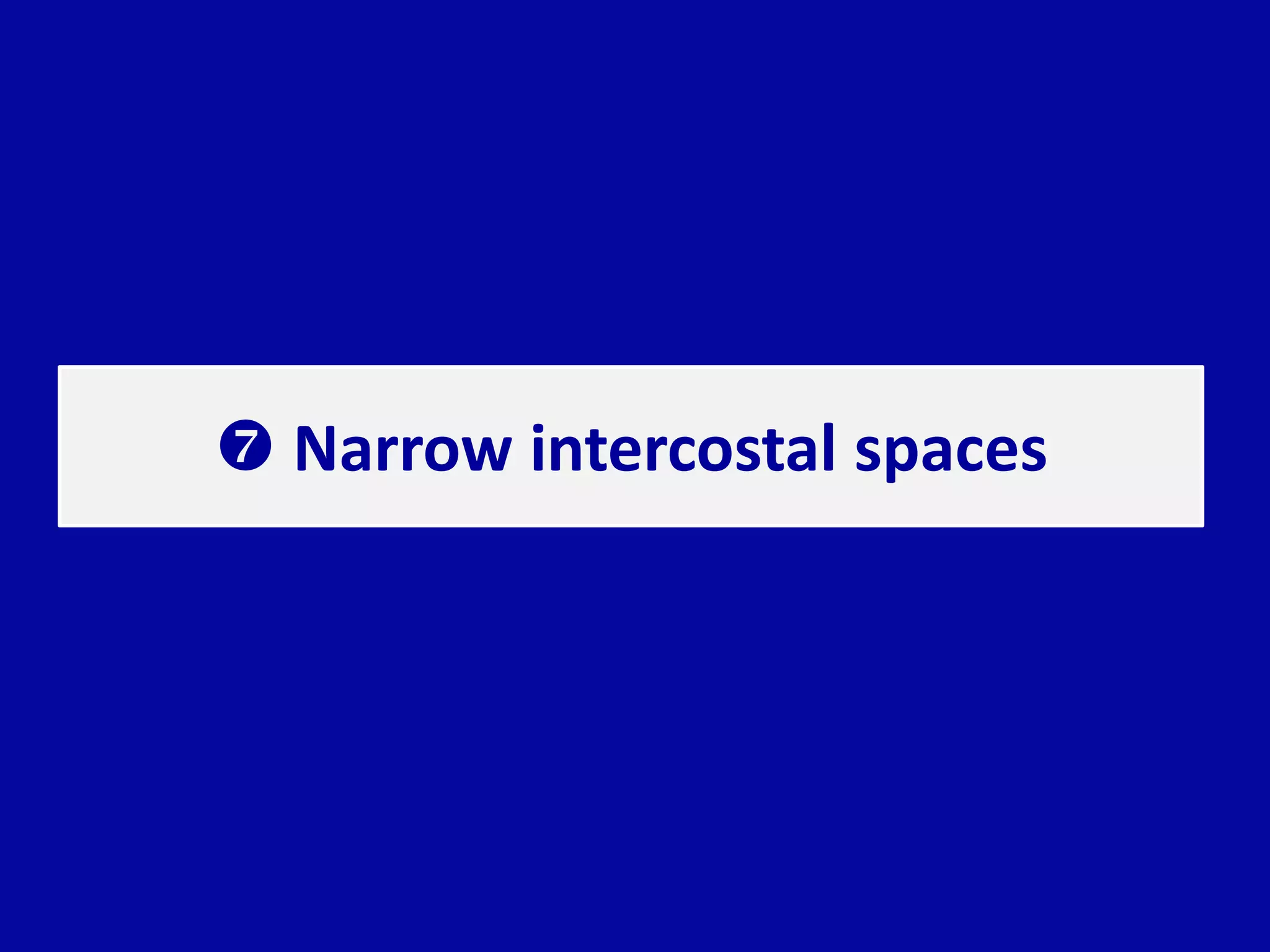  Narrow intercostal spaces
 