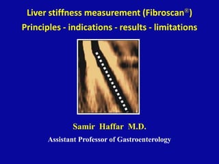 Liver stiffness measurement (Fibroscan®)
Principles - indications - results - limitations
Samir Haffar M.D.
Assistant Professor of Gastroenterology
 