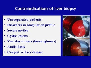 Contraindications of liver biopsy
• Uncooperated patients
• Disorders in coagulation profile
• Severe ascites
• Cystic les...