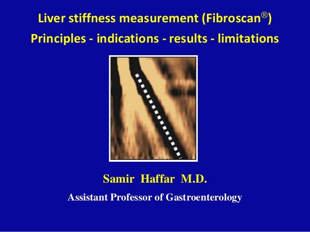 Liver Stiffness Chart