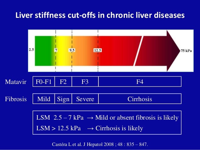 Liver Stiffness Chart