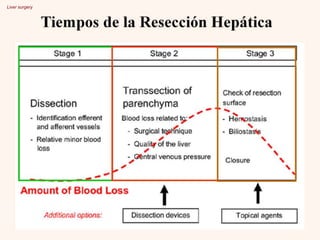 Liver surgery
 
