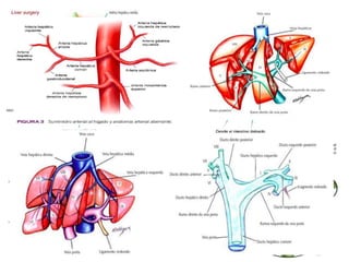 Liver surgery
 