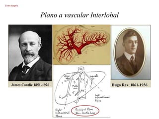 Plano a vascular Interlobal
Liver surgery
 