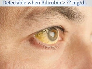 Detectable when Bilirubin > ?? mg/dl.
 
