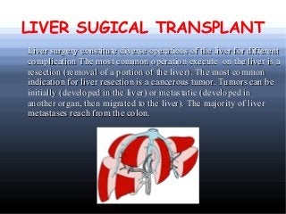 LIVER SUGICAL TRANSPLANT
Liver surgery constitute diverse operations of the liver for different
complication The most common operation execute on the liver is a
resection (removal of a portion of the liver). The most common
indication for liver resection is a cancerous tumor. Tumors can be
initially (developed in the liver) or metastatic (developed in
another organ, then migrated to the liver). The majority of liver
metastases reach from the colon.

 