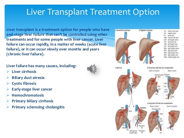 Liver cancer and transplants