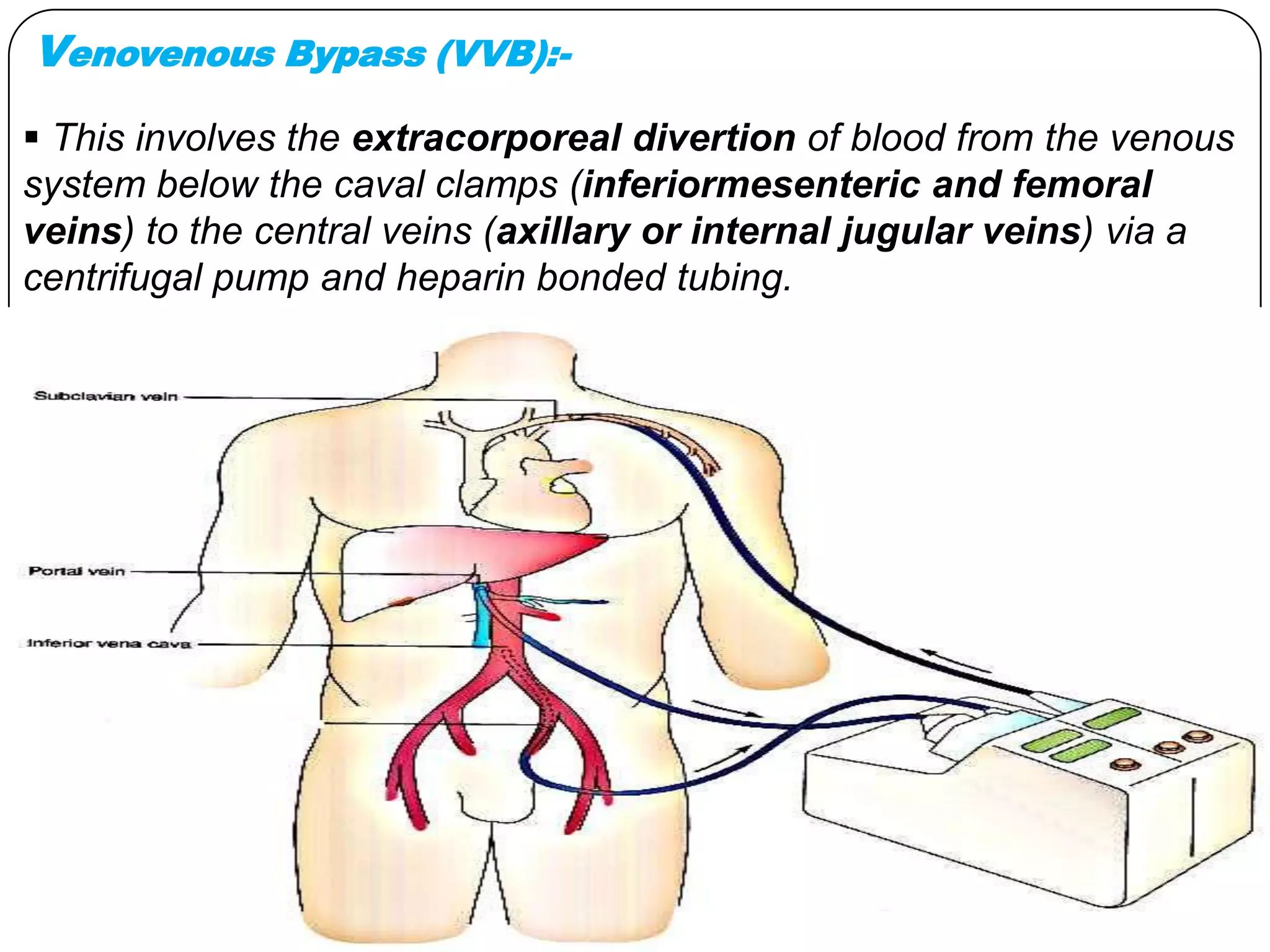 Liver transplantation & its anaesthetic management | PPTX