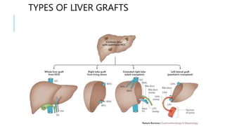 TYPES OF LIVER GRAFTS
 