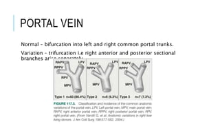 PORTAL VEIN
Normal – bifurcation into left and right common portal trunks.
Variation – trifurcation i.e right anterior and posterior sectional
branches arise separately
 