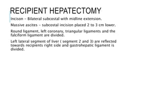 RECIPIENT HEPATECTOMY
Incison - Bilateral subcostal with midline extension.
Massive ascites - subcostal incision placed 2 to 3 cm lower.
Round ligament, left coronary, triangular ligaments and the
falciform ligament are divided.
Left lateral segment of liver ( segment 2 and 3) are reflected
towards recipients right side and gastrohepatic ligament is
divided.
 
