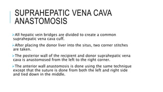 SUPRAHEPATIC VENA CAVA
ANASTOMOSIS
All hepatic vein bridges are divided to create a common
suprahepatic vena cava cuff.
After placing the donor liver into the situs, two corner stitches
are taken.
The posterior wall of the recipient and donor suprahepatic vena
cava is anastomosed from the left to the right corner.
The anterior wall anastomosis is done using the same technique
except that the suture is done from both the left and right side
and tied down in the middle.
 
