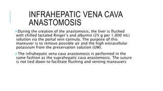 INFRAHEPATIC VENA CAVA
ANASTOMOSIS
During the creation of the anastomosis, the liver is flushed
with chilled lactated Ringer’s and albumin (25 g per 1,000 mL)
solution via the portal vein cannula. The purpose of this
maneuver is to remove possible air and the high extracellular
potassium from the preservation solution (UW).
The infrahepatic vena cava anastomosis is performed in the
same fashion as the suprahepatic cava anastomosis. The suture
is not tied down to facilitate flushing and venting maneuvers
 