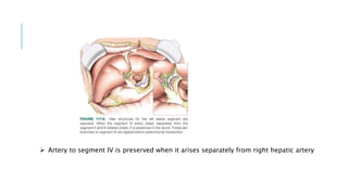  Artery to segment IV is preserved when it arises separately from right hepatic artery
 